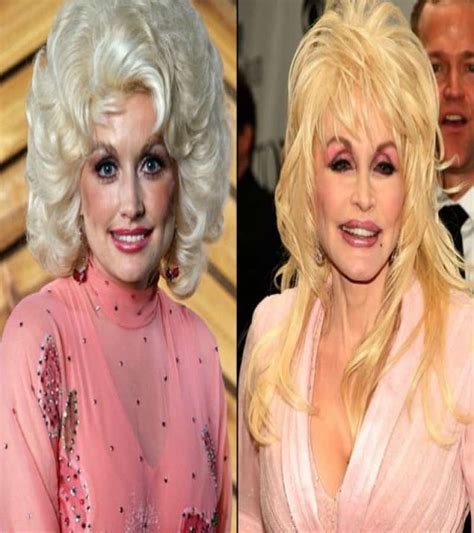 Worst Celebrity Plastic Surgeries 